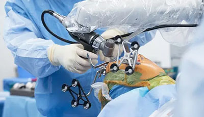 Robotic Surgery